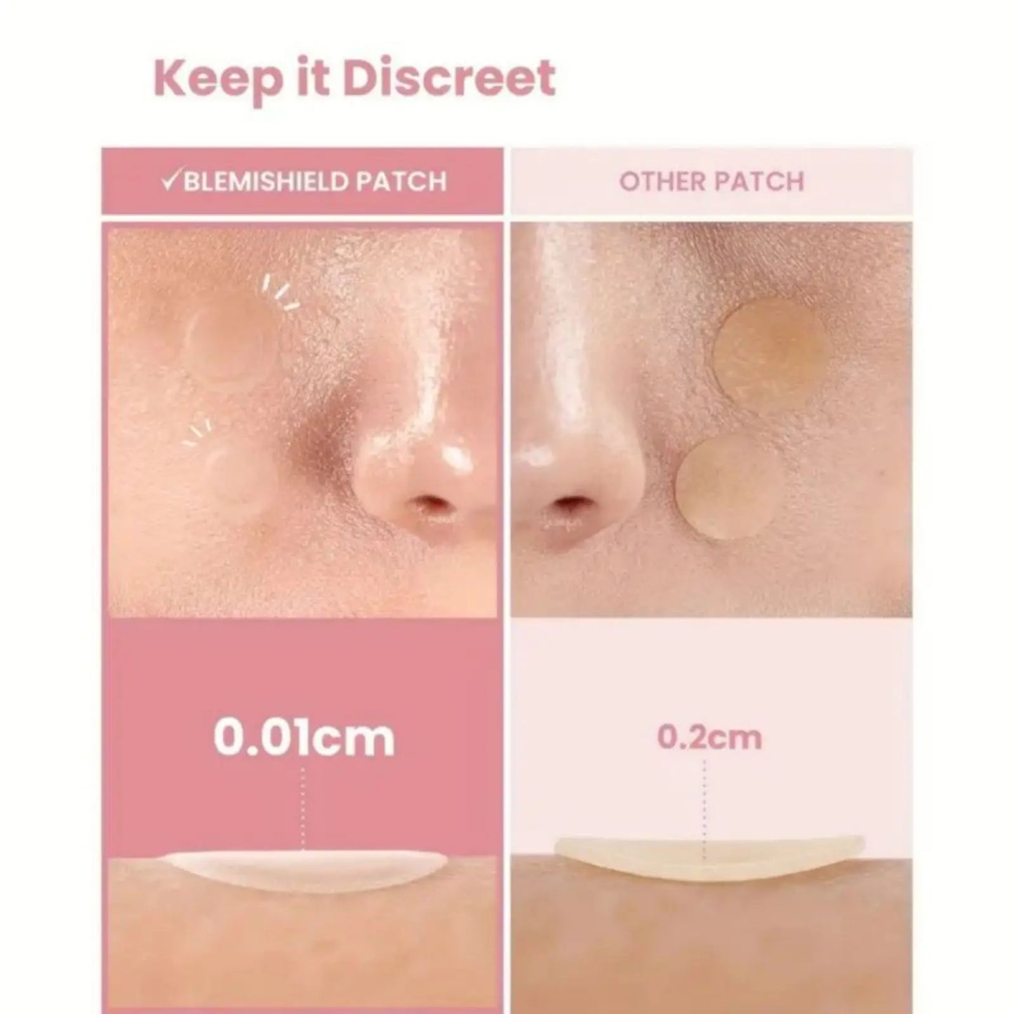 40 pieces of multi-color star acne patches,